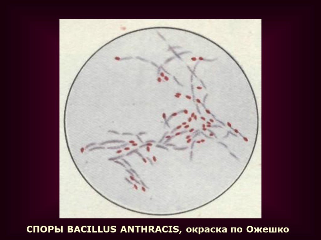 Окраска спор бактерий. Бациллы окраска по Ожешко. Окраска Ожешко Bacillus anthracis. Bacillus anthracis окраска по Ожешко. Окраска микроорганизмов по Ожешко бациллы.