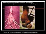 Слева желудок свиньи, забитый аскаридами. Справа нога больного слоновьей болезнью, вызываемой поселяющейся в лимфатических протоках нитчаткой Банкрофта
