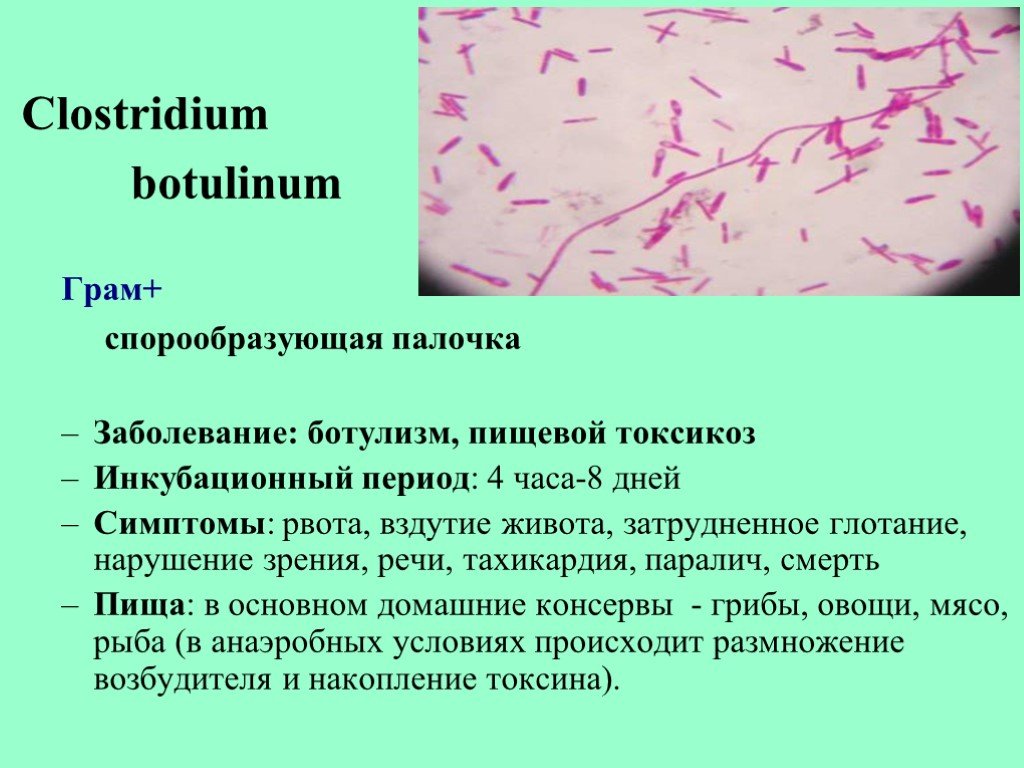 Кластридии. Clostridium perfringens микробиология. Клостридии ботулизма морфология. Палочки ботулизма Clostridium botulinum. Клостридии ботулизма ( Clostridium botulinum ) ботулизм.
