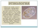 Этиология. Возбудителями малярии являются одноклеточные микроорганизмы, относящиеся к типу простейших (Protozoa), классу Sporozoa, poдy Plasmodium. Известно около 60 видов плазмодиев у животных и птиц; малярию человека вызывают 4 вида возбудителя: Plasmodium falciparum - возбудитель тропической маля
