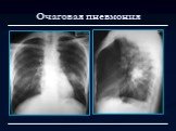 Лучевая диагностика заболеваний органов дыхания Слайд: 17