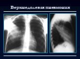 Лучевая диагностика заболеваний органов дыхания Слайд: 4