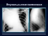 Лучевая диагностика заболеваний органов дыхания Слайд: 6