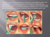 Учитывая индивидуальные особенности полости рта, целесообразно чистить зубы так называемым «стандартным методом», который сочетает горизонтальные ,вертикальные и круговые движения. Точность и тщательно выполненная процедура чистки зубов являются определяющими факторами эффективности гигиены полости 
