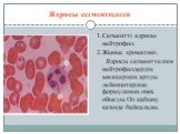 Ядросы сегменттелген. 1.Сегментті ядролы нейтрофил. 2.Жыныс хроматині. Ядросы сегменттелген нейтрофилдердің мөлшерінің артуы лейкоцитарлық формуланың оңға ойысуы.Ол қабыну кезінде байқалады.