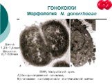 ГОНОКОККИ Морфология N. gonorrhoeae. ПЭМ, Ультратоний срез. А) бинарное деление гонококка; Б) гонококки на поверхности эпителиальной клетки. Длина: 1,25-1,6мкм Ширина: 0,7-0,9мкм
