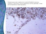 Микроскопическая морфология werneckii Exophiala показаны типичные 2-клеточные, светло-коричневые клетки дрожжей, с темно-пигментированные перегородками,