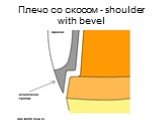 Плечо со скосом - shoulder with bevel