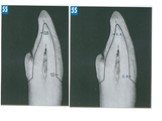 Теоретические аспекты препарирования зубов под искусственные коронки Слайд: 55