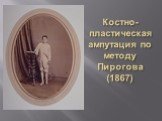 Костно-пластическая ампутация по методу Пирогова (1867)