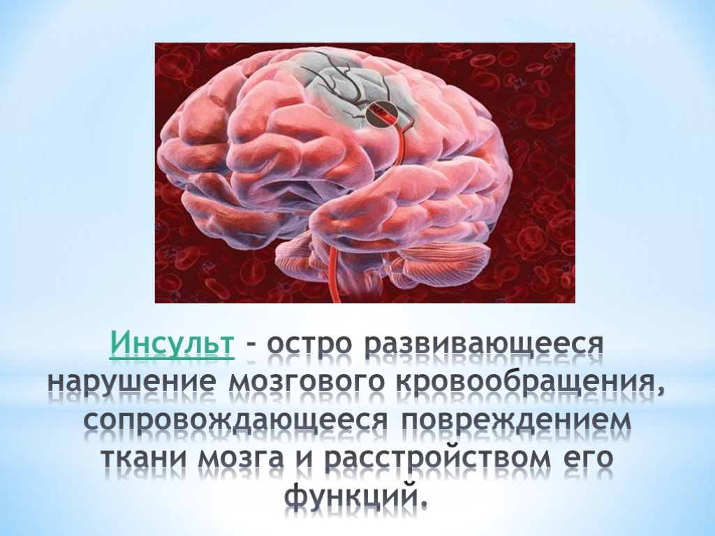 Острое нарушение мозгового кровообращения. Мозговой инсульт-острое нарушение мозгового кровообращения. Нарушения мозгового кровоснабжения. Нарушение кровообращения головного мозга. Острые и хронические нарушения мозгового кровообращения.