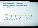 Монополярное течение (депрессивное рекуррентное расстройство)