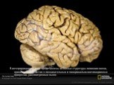 В интегрированном виде представлены основные структуры головного мозга, принимающие участие в познавательных и эмоционально-мотивационных процессах, рассмотренных выше.