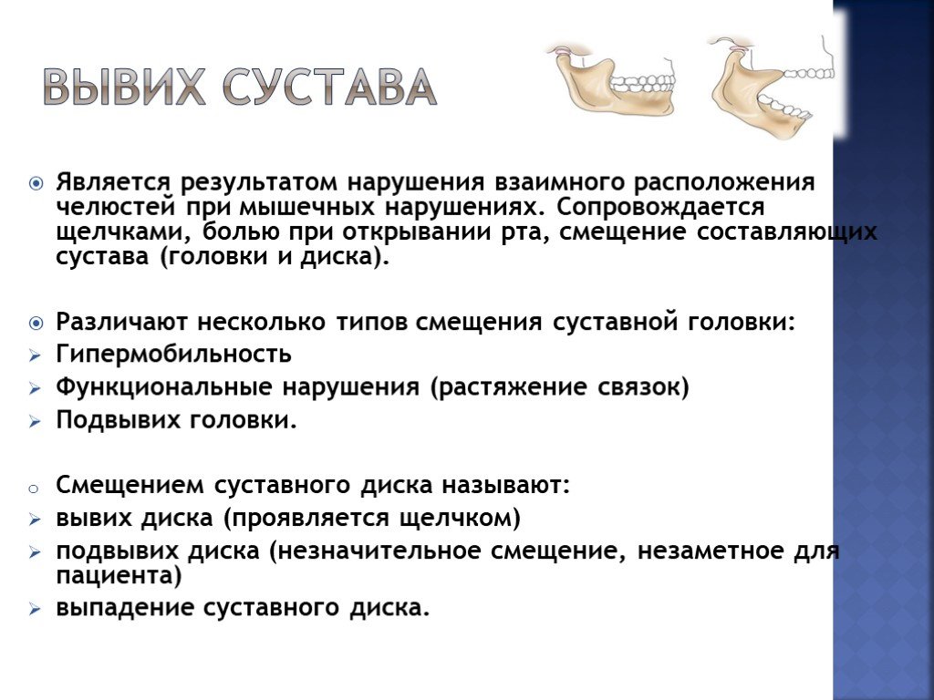 Вывих челюсти