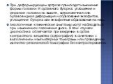 При деформирующем артрозе происходят изменения формы головки И суставного бугорка: уплощение и стирание головки по высоте, остроконечная или булавовидная деформация и образование экзофитов, уплощение бугорка или экзофитные образования на нем. Аналогичные клинические симптомы могут наблюдаться при из