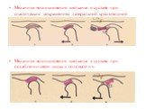 Механизм возникновения щелканья в суставе при спастических сокращениях латеральной крыловидной мышцы. Механизм возникновения щелканья в суставе при ослаблении связи диска с головкой н/ч.