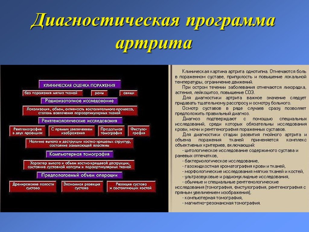 Гнойные заболевания суставов. Диагностические программы. Лекция гнойные заболевания костей и суставов. Диагностическая программа это в медицине. План диагностики.