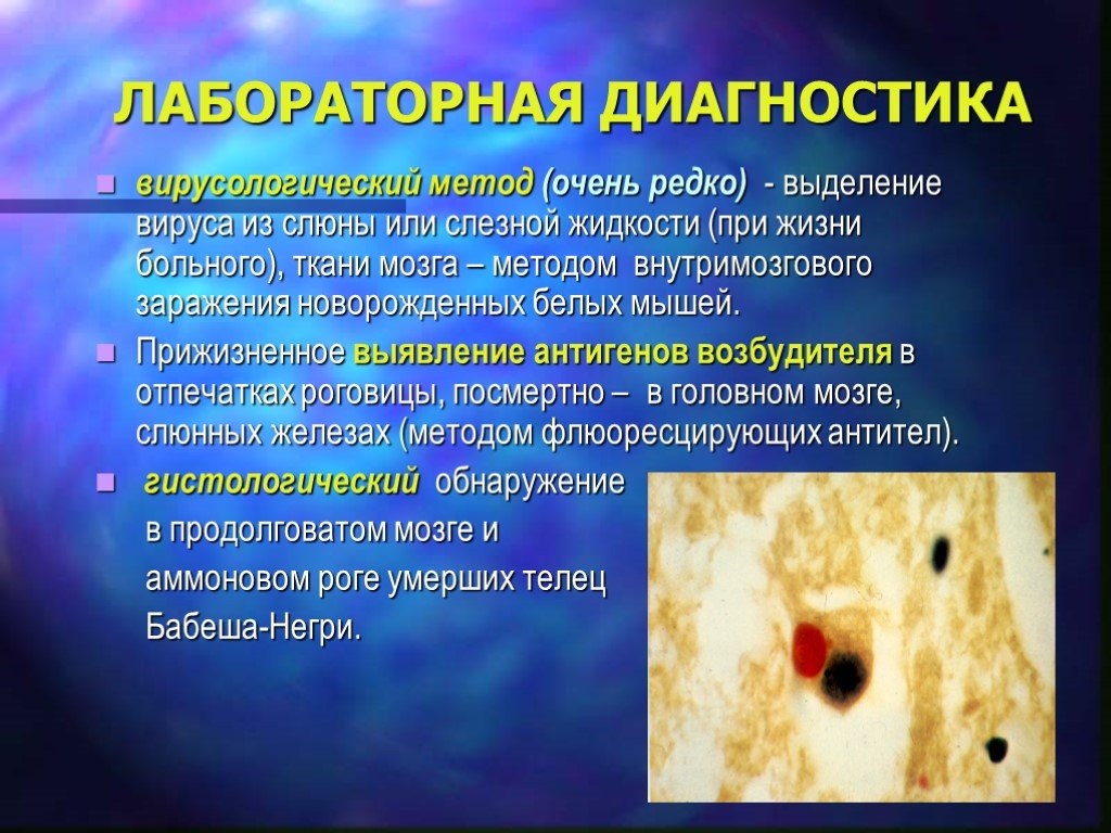 Лептоспироз гепатит