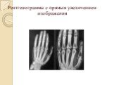 Рентгенограммы с прямым увеличением изображения