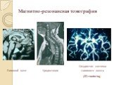 Магнитно-резонансная томография. Головной мозг Средостение. Сосудистая система головного мозга (3D-rendering)