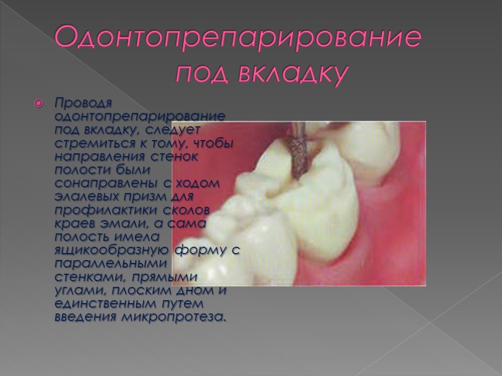 Ошибки и осложнения при изготовлении вкладок презентация