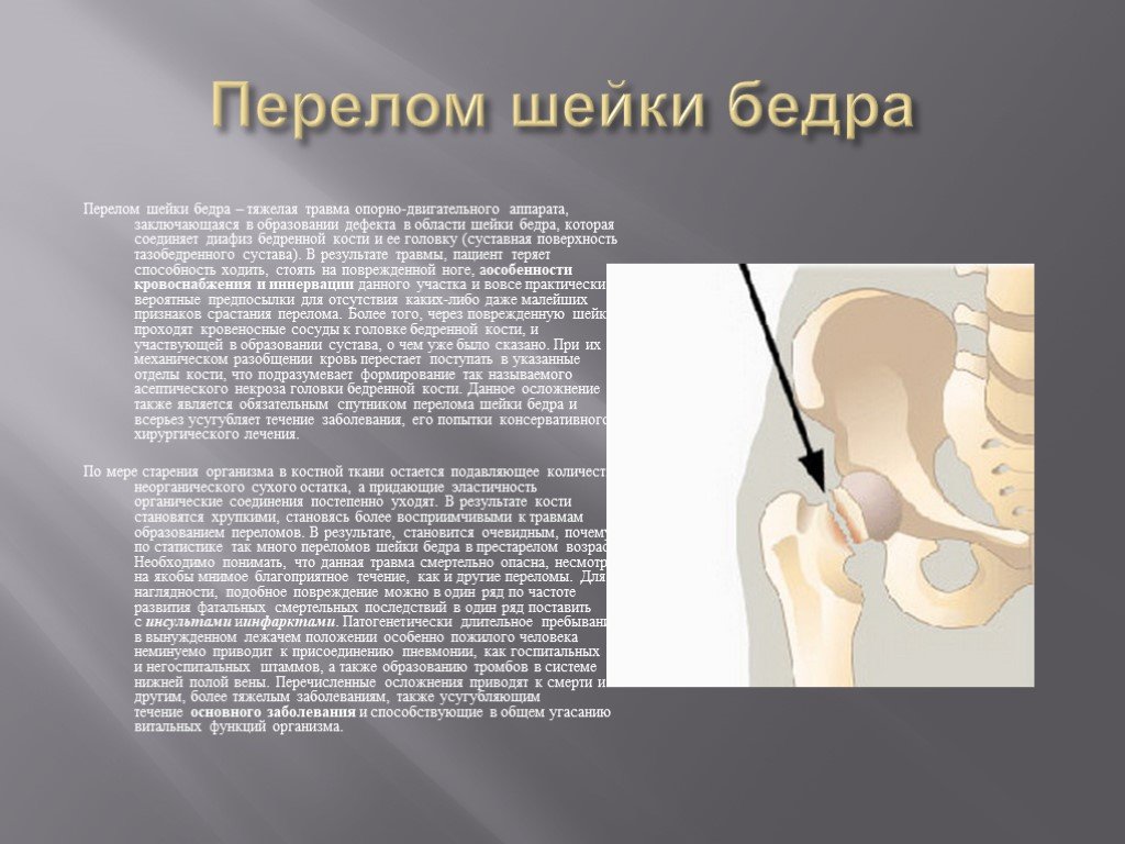 Трещина шейки. Симптомы повреждения тазобедренного сустава. Клинические проявления перелома шейки бедра. Симптом перелома шейки бедренной кости. Основными признаками перелома шейки бедра являются.