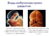 Виды эмбриона в сроки развития. Пятинедельный эмбрион длина 9 мм, уже угадывается лицо с отверстиями для рта, ноздрей и глаз. 40 дней - наружные клетки зародыша срослись с рыхлой поверхностью матки и образуют плаценту, или детское место.