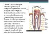 Crown - this is the part which is partially or completely protrudes above the gum after eruption. External hard dental crown is covered with enamel, comprising a compound florets. Under it is a dense substance similar to bone (dentin). The root is surrounded by a layer of special material - dental c