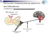 Истинное головокружение (вертиго) – вестибулярное (связанное с вестибулярным аппаратом). Внутреннее ухо /лабиринт/. Периферические нейроны. Вестибулярный нерв. Ствол мозга