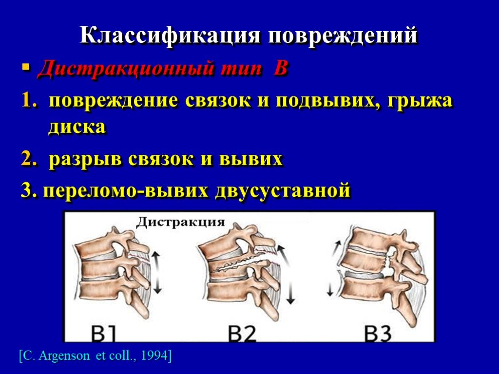 Виды связок