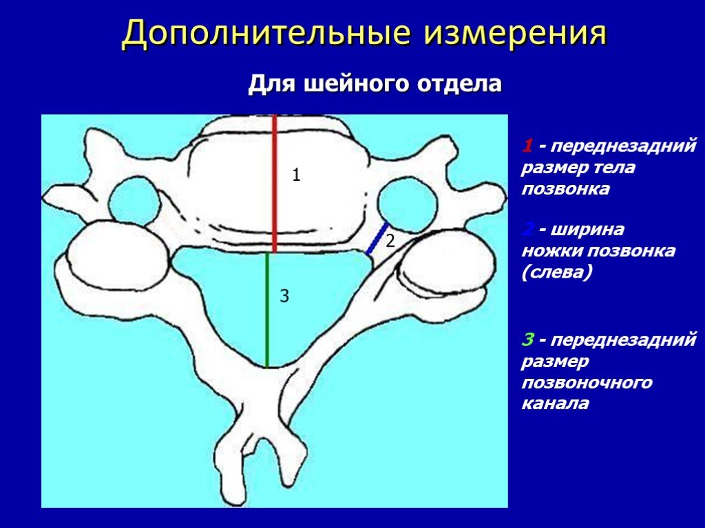 Тело позвонка размер. Переднезадний размер позвоночного канала. Сагиттальный размер позвоночного канала шейного отдела. Ширина позвоночного канала в норме.