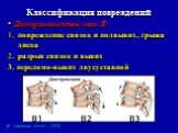 Дистракционный тип В повреждение связок и подвывих, грыжа диска разрыв связок и вывих 3. переломо-вывих двусуставной