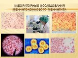 Лабораторные исследования менингококкового менингита