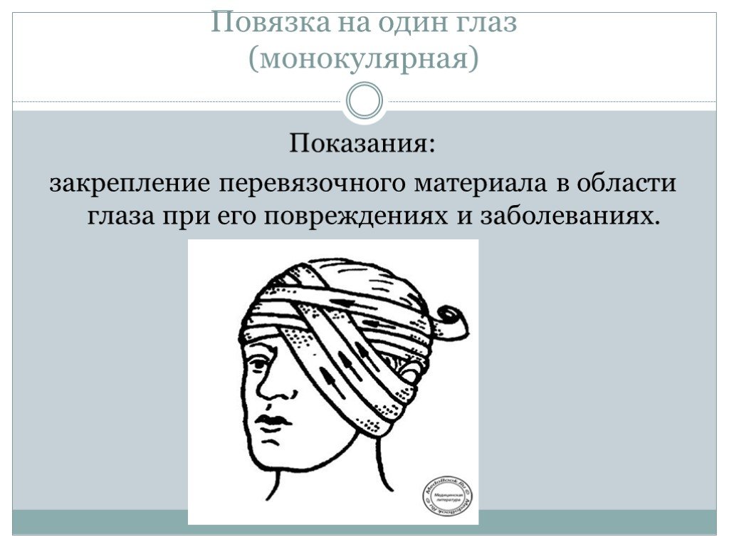 Повязка алгоритм. Монокулярная повязка на глаз показания. Наложение повязки на один глаз монокулярная. Монокулярная повязка показания. Повязка на глаз десмургия.