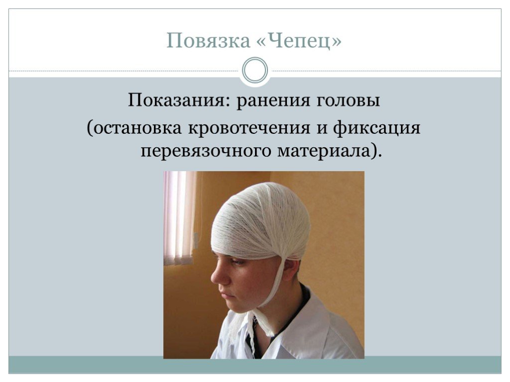 Повязка чепец. Повязка чепец показания. Повязка чепец показания к наложению. Перевязка чепец. Медицинская повязка на голову чепец.