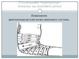 Сходящаяся «черепашья» повязка на локтевой сустав. Показания: ранения выше или ниже локтевого сустава.