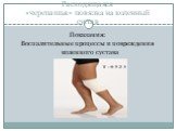 Расходящаяся «черепашья» повязка на коленный сустав. Показания: Воспалительные процессы и повреждения коленного сустава