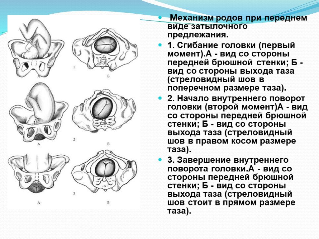 План ведения родов при головном предлежании