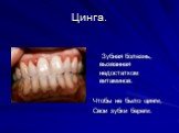 Цинга. Зубная болезнь, вызванная недостатком витаминов. Чтобы не было цинги, Свои зубки береги.