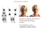 Монозиготные близнецы характеризуются большой степенью сходства (конкордантностью) по многим признакам. По тем признакам, которые контролируются генами, сходство сохраняется до глубокой старости.