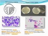 Метод посева штрихом. На питательных средах. Грамположительная Bacillus anthracis (фиолетовые палочки) в образце спинномозговой жидкости. (Другие клетки — лейкоциты). Окраска по Граму Staphylococcus aureus (грамположительные кокки) иEscherichia coli (грамотрицательные бациллы)