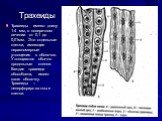 Трахеиды. Трахеиды имеют длину 1-4 мм, в поперечном сечении от 0,1 до 0,01мм. Это отдельные клетки, имеющие неравномерные утолщения в оболочке. Утолщаются обычно продольные стенки. Каждая трахеида обособлена, имеет свою оболочку. Трахеиды – неперфорированные клетки.