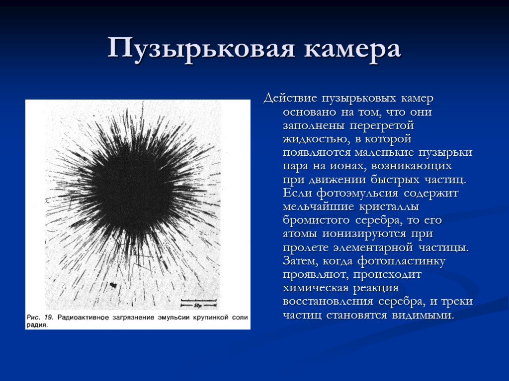 Пузырьковая камера рисунок