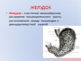 ЖЕЛУДОК. Желудок – эластичное мешкообразное расширение пищеварительного тракта, расположенное между пищеводом и двенадцатиперстной кишкой.