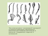 Типы усиков насекомых: 1-щетинковидный, 2-нитевидный, 3-четковидный, 5-гребневидный, 6-булавовидный, 7-головчатый, 8-веретеновидный, 9-пластинчатый, 10-коленчатый, 11-неправильный, 12-перистый, 13-щетинконосный.
