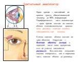 Зрительный анализатор. Орган зрения — важнейший из органов чувств, обеспечивающий человеку до 90% информации. Периферическая часть анализатора — орган зрения состоит из глазного яблока и вспомогательных органов: веки, ресницы, слезные железы, глазодвигательные мышцы. Стенка глазного яблока состоит и