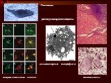 Гистиоцит. ретикулоэндотелиоциты. альвеолярные макрофаги. остеокласты. микроглиальные клетки