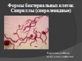 Формы бактериальных клеток. Спириллы (спиралевидные). Treponema pallidum возбудитель сифилиса