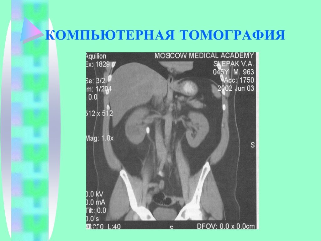 Семиотика урологических заболеваний презентация