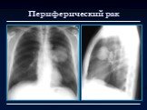Лучевая диагностика заболеваний органов дыхания Слайд: 3